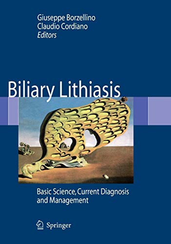 Biliary Lithiasis: Basic Science, Current Diagnosis and Management