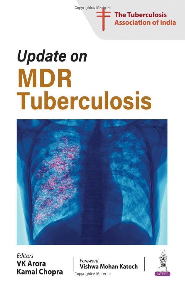 UPDATE ON MDR TUBERCULOSIS