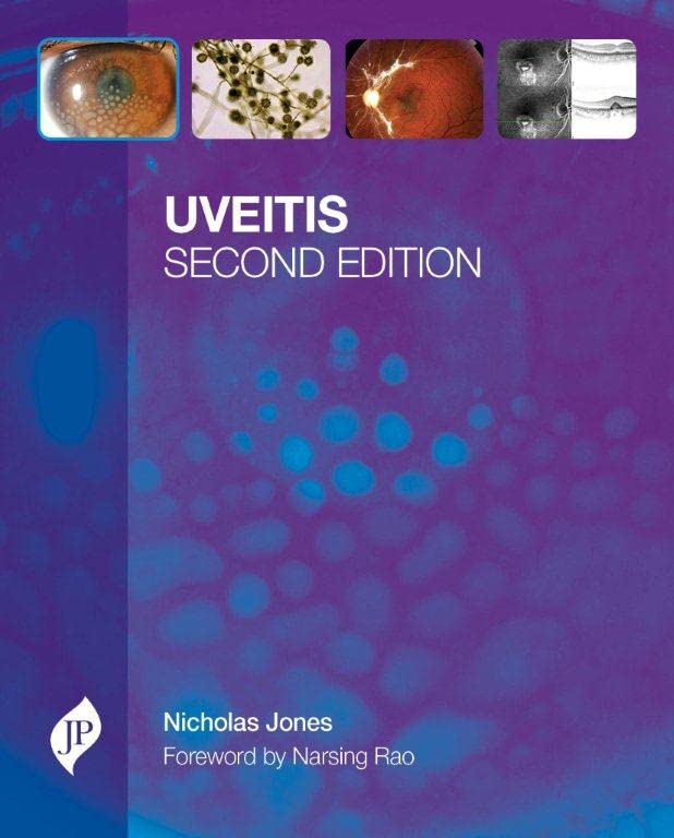 Uveitis with CD-ROM