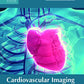 Cardiovascular Imaging: Modern Methods and Technologies