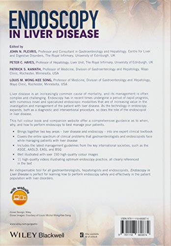 Endoscopy In Liver Disease (Hb 2018)