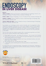 Endoscopy In Liver Disease (Hb 2018)