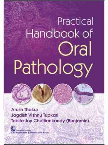 PRACTICAL HANDBOOK OF ORAL PATHOLOGY (PB 2021)
