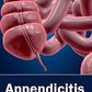 Appendicitis