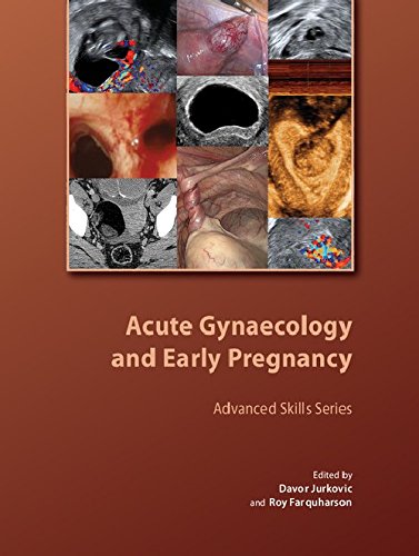 Acute Gynaecology and Early Pregnancy (Royal College of Obstetricians and Gynaecologists Advanced Skills)