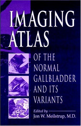 Imaging Atlas of the Normal Gallbladder and Its Variants