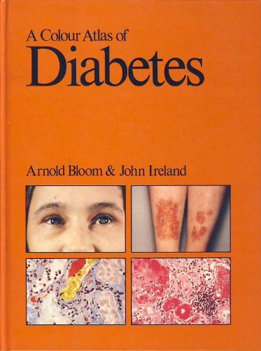 A Colour Atlas of Diabetes (Wolfe medical atlases)