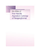 An Atlas of Fine Needle Aspiration Cytology of Paragangliomas