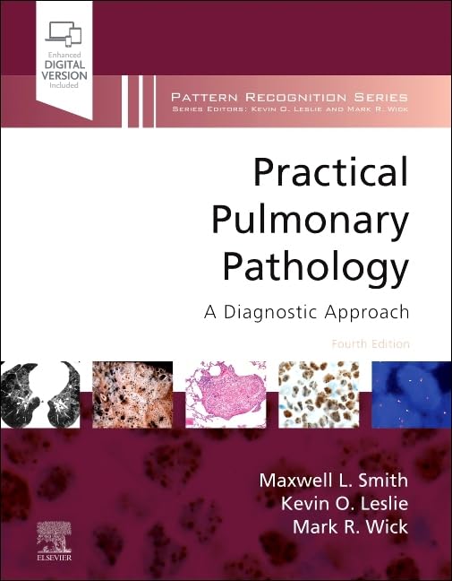 Practical Pulmonary Pathology: A Diagnostic Approach (Pattern Recognition)