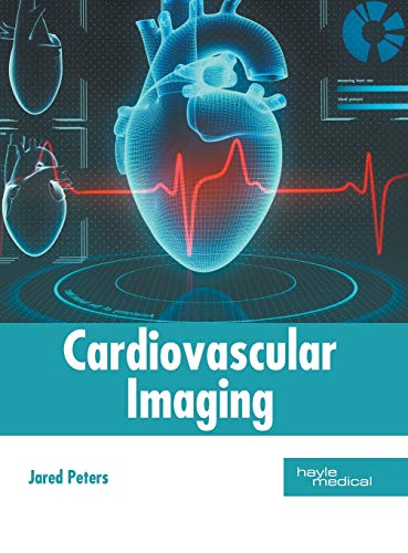 Cardiovascular Imaging