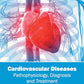 Cardiovascular Diseases: Pathophysiology, Diagnosis and Treatment