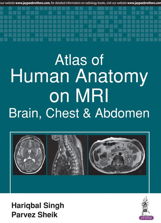 ATLAS OF HUMAN ANATOMY ON MRI:BRAIN, CHEST & ABDOMEN
