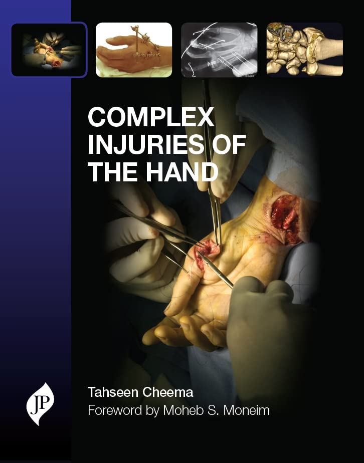 Complex Injuries of The Hand
