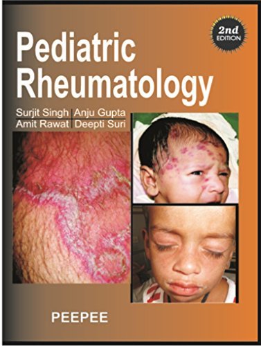 Pediatric Rheumatology