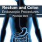 Rectum and Colon: Endoscopic Procedures