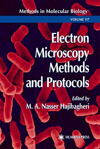 Electron Microscopy Methods and Protocols: v. 117 (Methods in Molecular Biology)