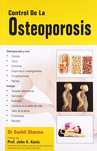 Control De La Osteoporosis: 1 - Retail Maharaj