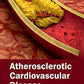 Atherosclerotic Cardiovascular Disease