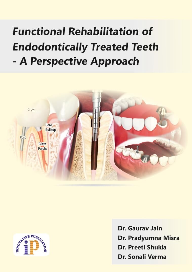 Functional Rehabilitation of Endodontically Treated Teeth - A Perspective Approach - Retail Maharaj