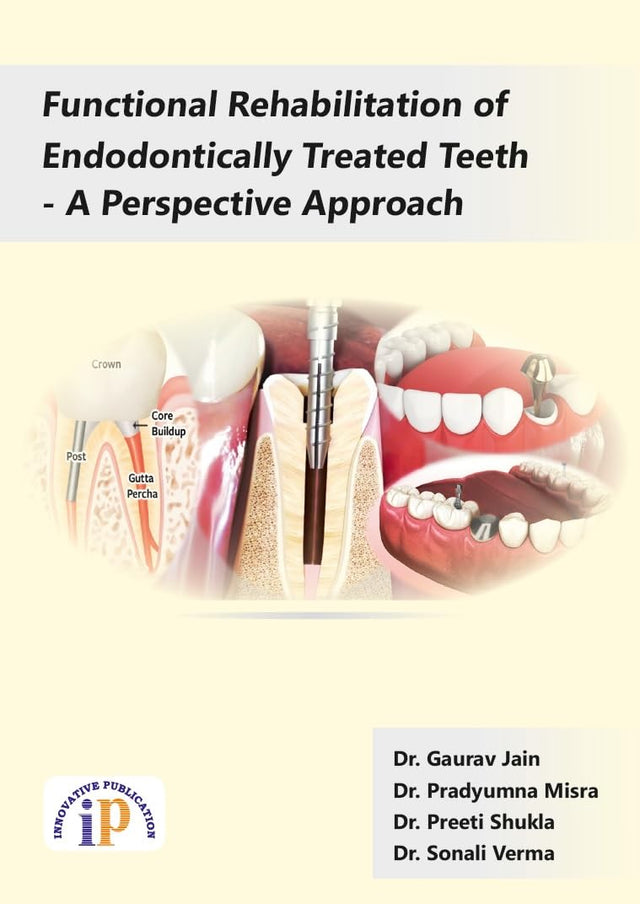 Functional Rehabilitation of Endodontically Treated Teeth - A Perspective Approach - Retail Maharaj