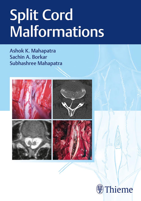 Split Cord Malformations - Retail Maharaj
