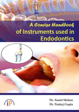 A Concise Handbook of Instruments used in Endodontics