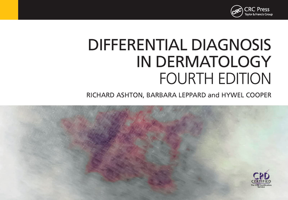 DIFFERENTIAL DIAGNOSIS IN DERMATOLOGY (EX)