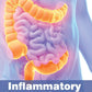 Inflammatory Bowel Disease