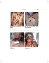 Practical Forensic Medicine and Toxicology, 2/e | As per the latest NMC Guidelines (PB 2026)