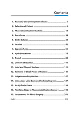 SIMPLIFIED PHACOEMULSIFICATION