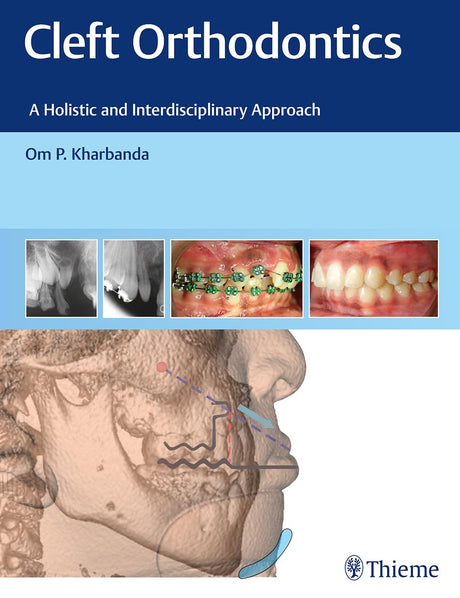 Cleft Orthodontics 1st Edition - Retail Maharaj