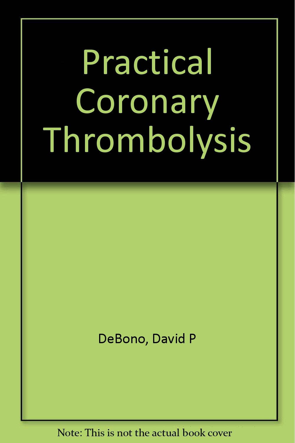 Practical Coronary Thrombolysis