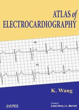 Atlas of Electrocardiography