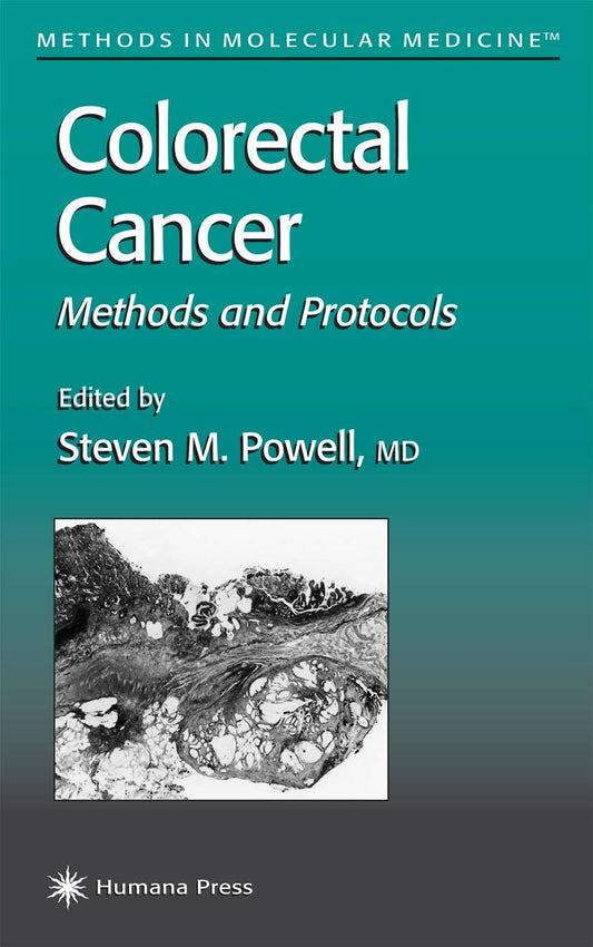 Colorectal Cancer Methods and Protocols