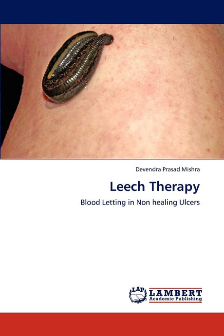 Leech Therapy: Blood Letting in Non healing Ulcers - Retail Maharaj