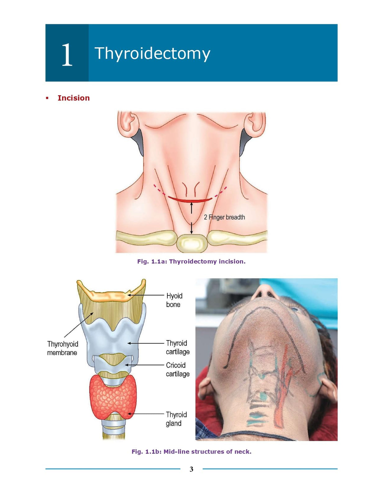 Essential Surgical Anatomy 1st/2026