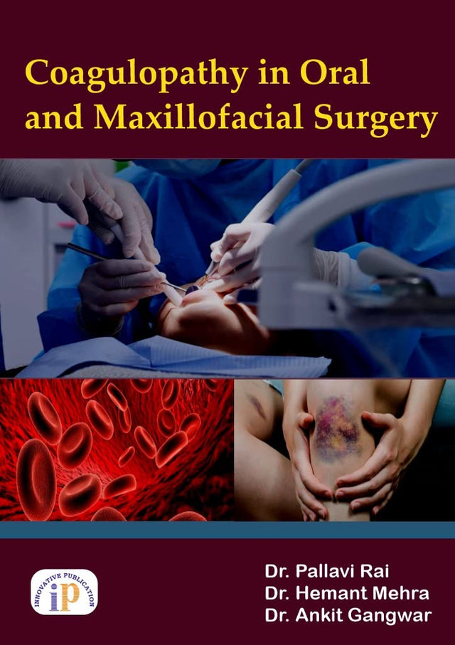 Coagulopathy in Oral and Maxillofacial Surgery - Retail Maharaj