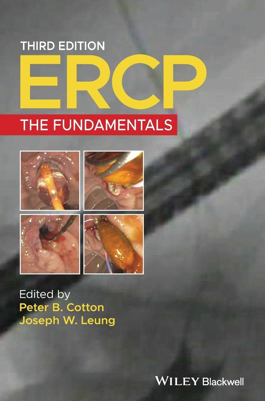 ERCP