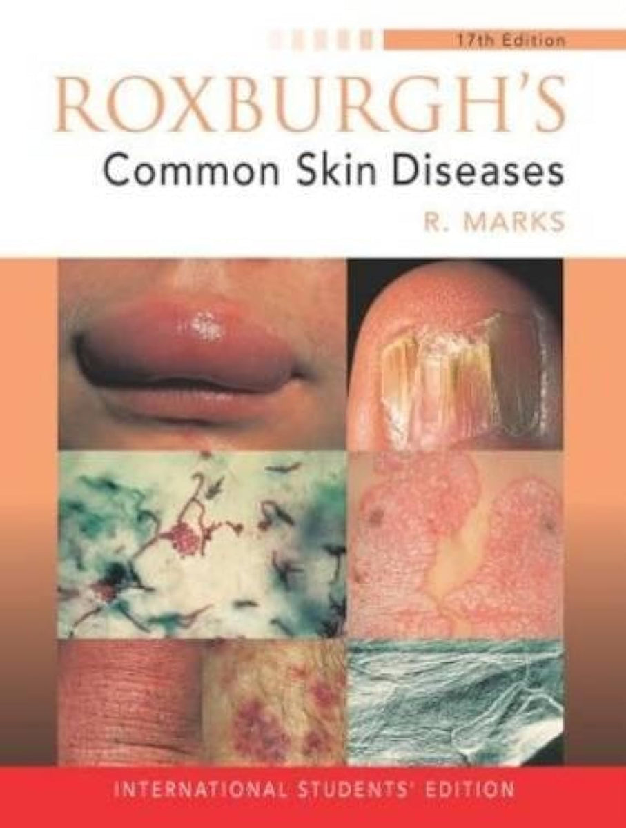 Old Roxburgh (EX)(OLD)ROXBURGH'S COMMON SKIN DISEASES | Retail Maharaj