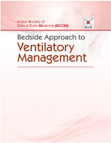 Bedside Approach to Ventilatory Management