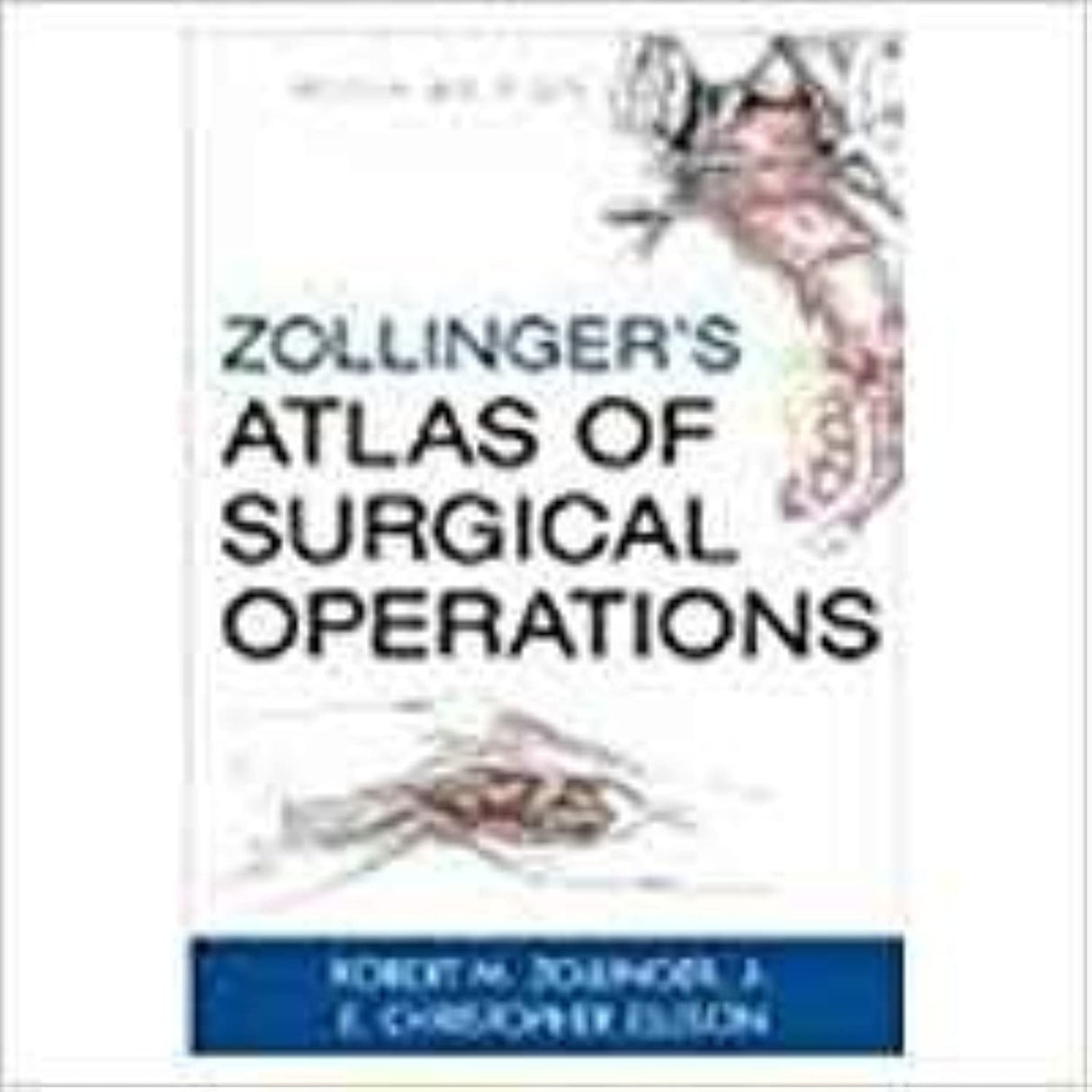 (OLD)ZOLLINGER'S ATLAS OF SURGICAL OPERATIONS(IE)