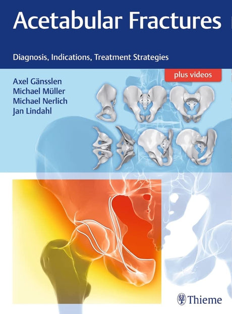 Acetabular Fractures: Diagnosis, Indications, Treatment Strategies - Retail Maharaj