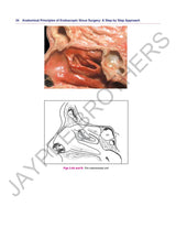 ANATOMICAL PRINCIPLES OF ENDOSCOPIC SINUS SURGERY: A STEP BY STEP APPROACH WITH INTERACTIVE CD-ROM