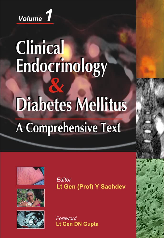 Clinical Endocrinology And Diabetes Mellitus:A Comprehensive Text- Vol.2 (MEDICAL/DENISTRY)