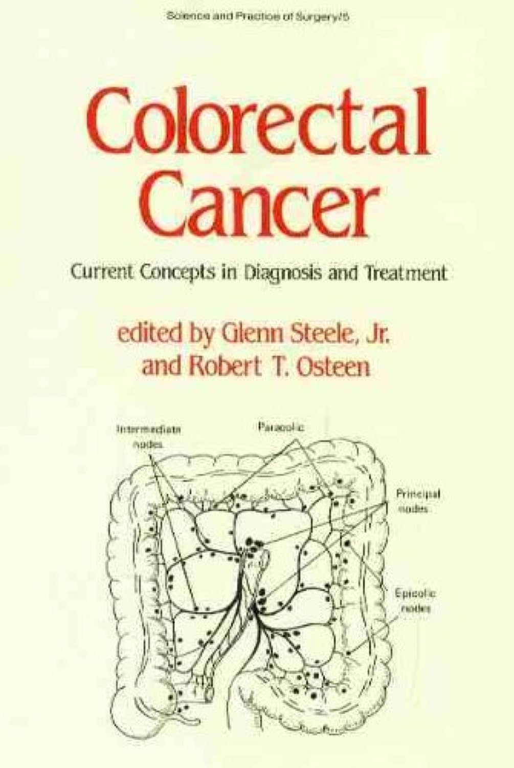 Colorectal Cancer: Current Concepts in Diagnosis and Treatment (Science & Practice of Surgery S.)