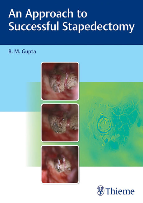 An Approach to Successful Stapedectomy - Retail Maharaj