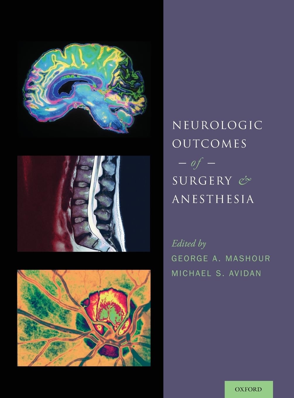 Neurologic Outcomes of Surgery and Anesthesia