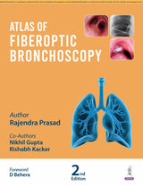 ATLAS OF FIBEROPTIC BRONCHOSCOPY