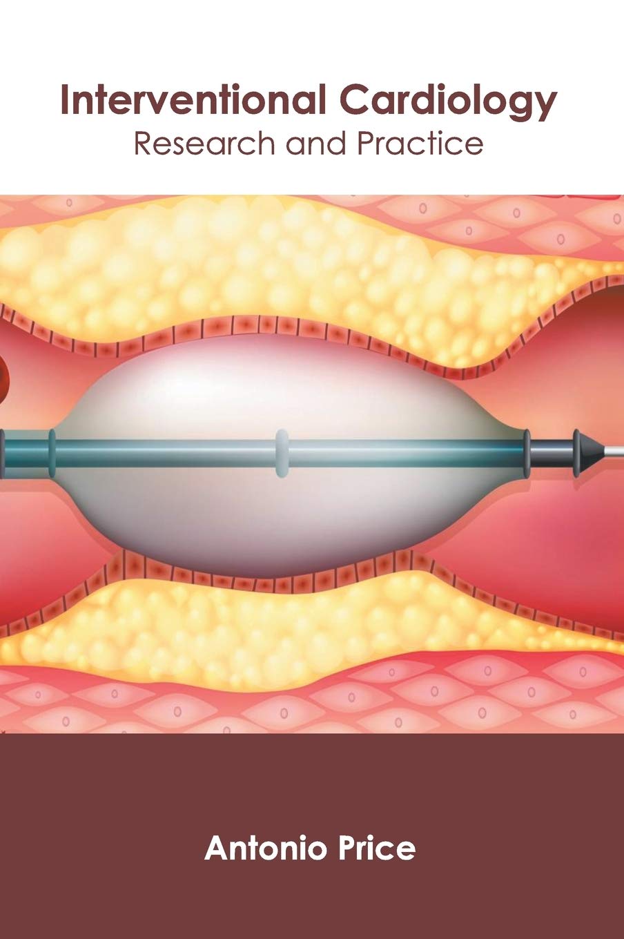 Interventional Cardiology: Research and Practice