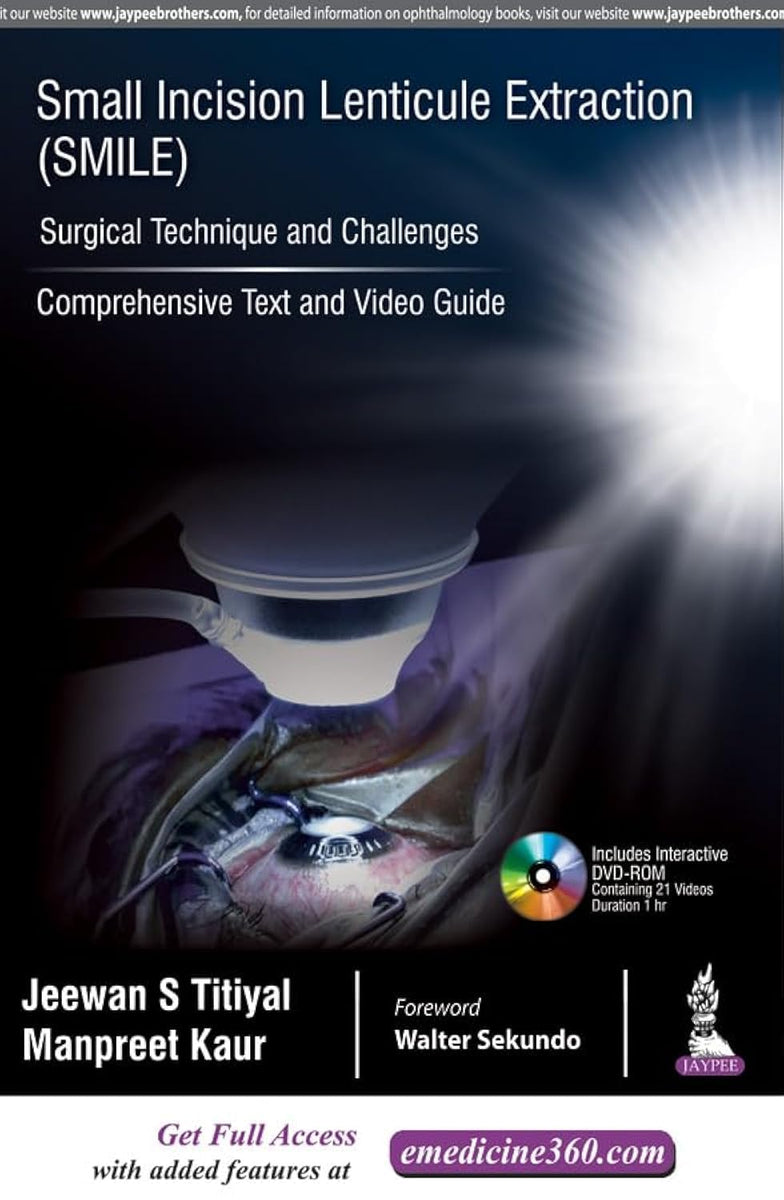 SMALL INCISION LENTICULE EXTRACTION (SMILE) SURGICAL TECHNIQUE AND CHA